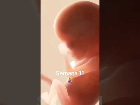 Week 11 🤰 #pregnancy #ultrasound #pregnant