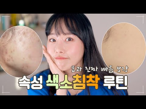 홈케어로만 색소침착 없애는법