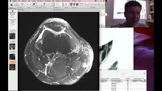 Sobreposição de Imagens