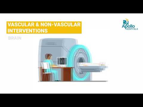 Dr. Suresh Giragani | Senior Interventional Radiologist at Apollo Hospitals, Hyderabad