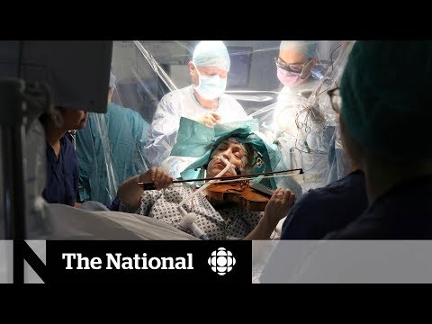 Violinist suggested playing during brain surgery