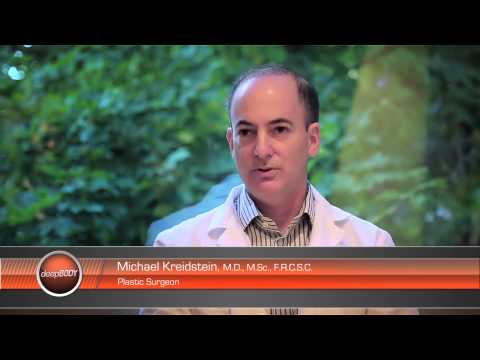 Dr. Michael Kreidstein Discusses Liposuction Techniques