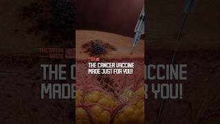 The cancer vaccine made just for you!