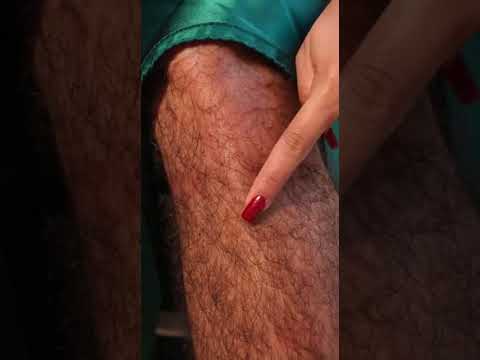 Hairy Poise and Power in One Quiet Moment