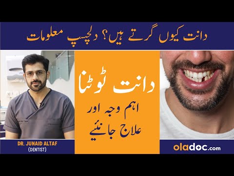 Dant Girne Ki Wajah Aur Ilaj - Missing Tooth Causes & Replacement - Dant Nikal Jaye To Kya Karen