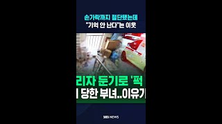 손가락까지 절단됐는데 
