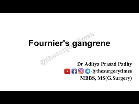 Fourniers’s Gangrene in detail (Definition, Etiology, c/f, lab investigations, management)