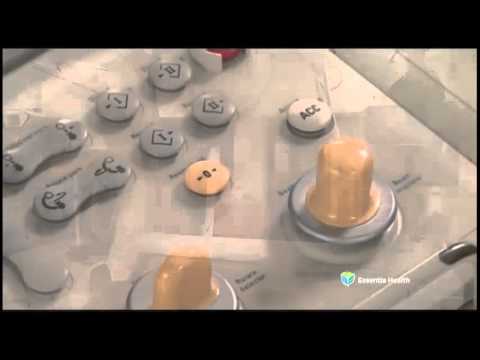 Medical Insight: STEMI - Essentia Health