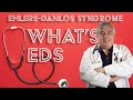 What is EDS?