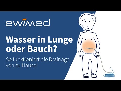 Water in the lungs or abdomen? - How to drain it at home!