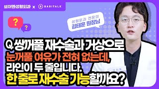 [브이엔성형외과 Q&A] 쌍꺼풀재수술과 이마거상 후 여유 없는 눈꺼풀, 그런데 라인이 두줄이라니! 한 줄로 재수술 가능할까요? #바비톡1분닥터 #김태훈원장 #성형외과전문의