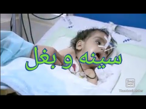 سینه و بغل چیست؟ اعراض و علایم سینه و بغل چیست؟ در مقابل سینه و بغل چی باید کرد؟