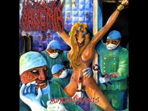 Absemia - Morbopraxis (Full Album)