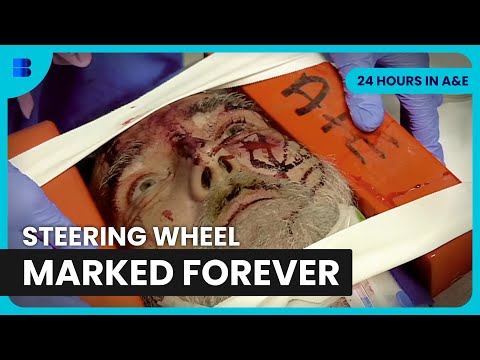 Lorry Driver Windscreen Impact Major Trauma | 24 Hours in A&E