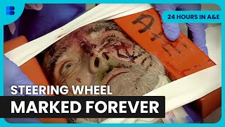 Lorry Driver Windscreen Impact Major Trauma | 24 Hours in A&E