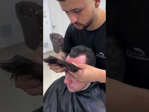 Mini prótese capilar