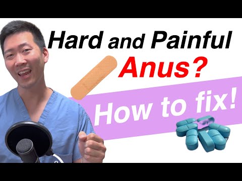 How to fix a hard and painful anus! | Dr. Chung explains.