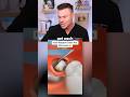 Dentist Reveals What REALLY Happens In Wisdom Teeth Removal