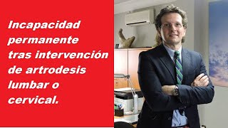 Incapacidad permanente por artrodesis lumbar o cervical.