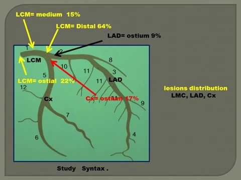 PTCA  Main disease  LMC