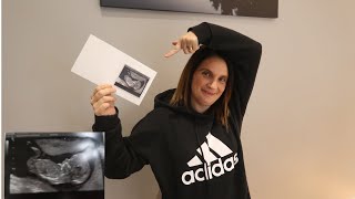 WE&#39;RE HAVING A BABY  !!!!