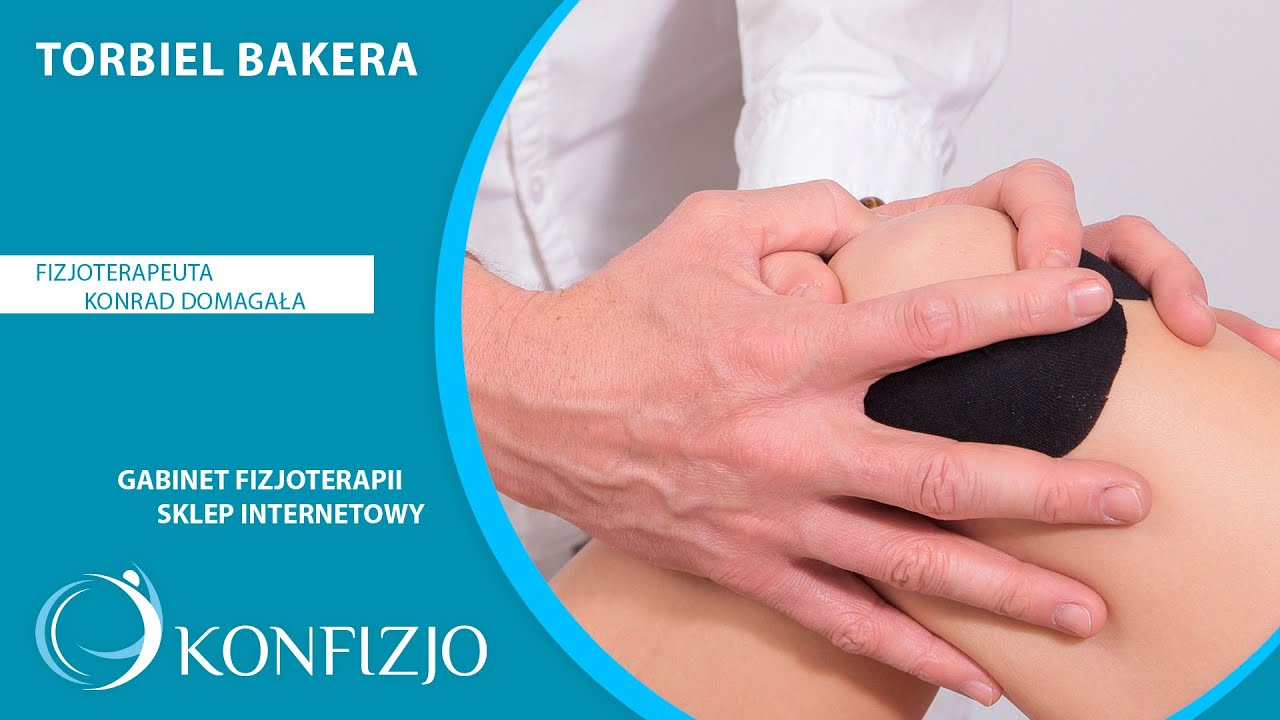 Torbiel Bakera  skąd się bierze i jak wygląda leczenie? - objawy, przyczyny, leczenie