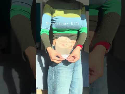 ✨ Convenience at its best! With Heagi 2-piece ostomy bags, switching is a breeze. #ostomybag #ostomy