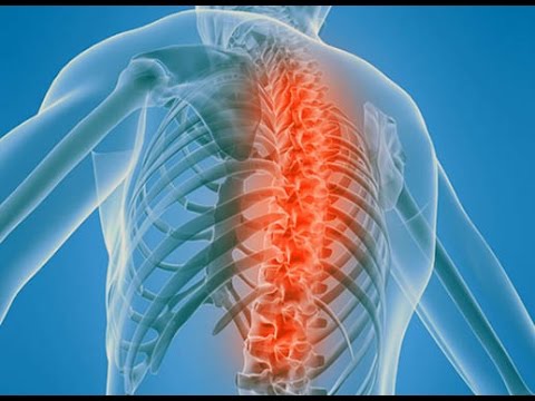 Боль в грудной клетке и пояснице Болит спина когда прогибаешься