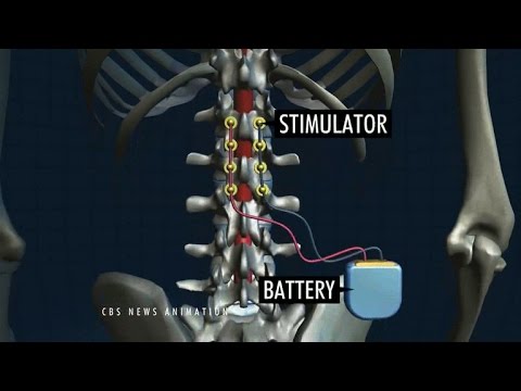 Wearable Technology That Is Changing Lives