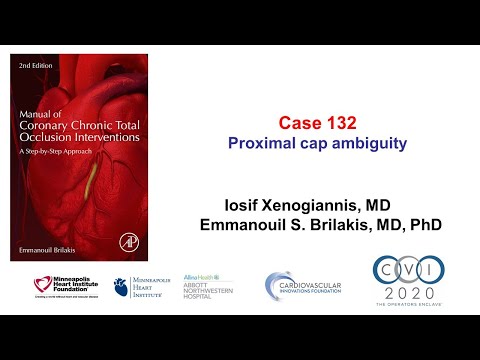 Case 132: Manual of CTO interventions: Proximal cap ambiguity
