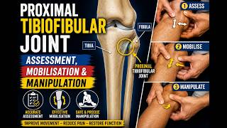 Assess, Mobilise & Manipulate the Proximal Tibia Fibula Joint