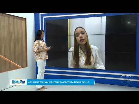 Como lidar com a calvície feminina através da terapia capilar 24 01 2023