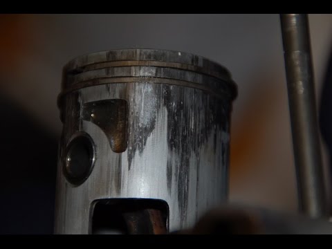 Mal di schiena adenoma Risonanza magnetica del ginocchio prezzi Bryansk