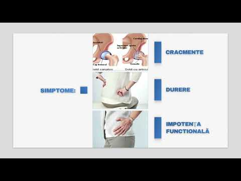 durerile articulare sunt simple