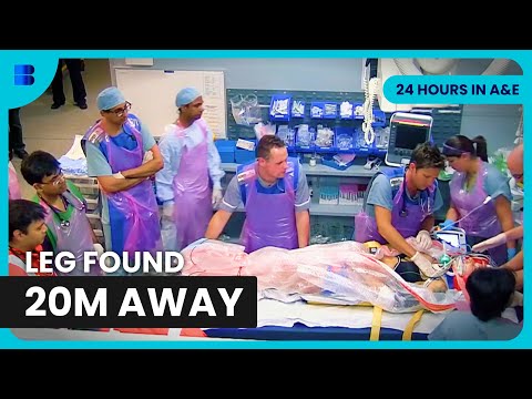 Motorcyclist Loses Leg After High Speed Crash | 24 Hours In A&E