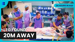 Motorcyclist Loses Leg After High Speed Crash | 24 Hours In A&E