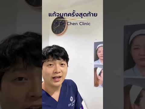 เคยเสริมจมูก ขาซิลิโคนโผล่ ติดเชื้อ จากที่อื่น พักจมูกแล้ว มาเสริมใหม่ ที่ Dr. Chen Clinic EP.1   เคยเสริมจมูก ขาซิลิโคนโผล่ ติดเชื้อ จากที่อื่น พักจมูกแล้ว มาเสริมใหม่ ที่ Dr. Chen Clinic EP.1