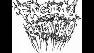 Facial Bite Wound - Woundead (Blood Cover)