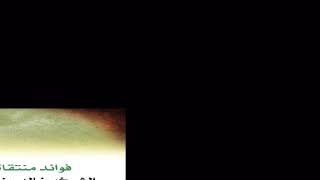 الفرق بين التكييف والتمثيل || الشيخ خالد الفليج image