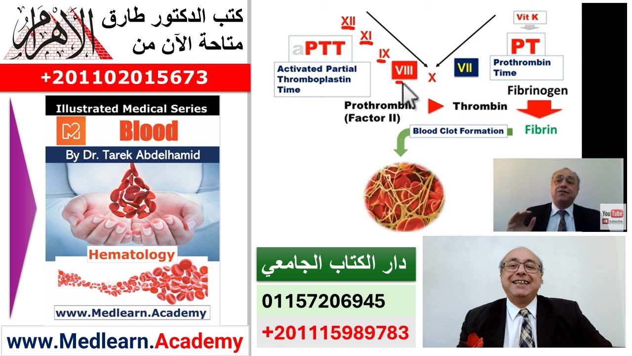 Coagulopathy (General)   #cme #internal_medicine #medical #usmle #محاضرات_باطنة #USMLE