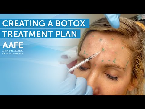 Botox Treatment Plan and Techniques | AAFE