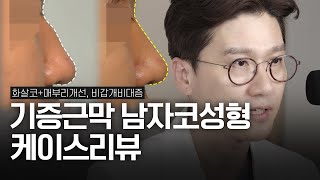 “측면에서 화살코+매부리 더 심했던 이유?” 무보형물 코성형 3개월 경과 | 미간 꺼짐+복코+비주비순각 개선 케이스 리뷰