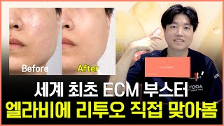 원장님이 직접 시술해봤습니다! 엘라비에 리투오 리얼 후기 | 모공 흉터 걱정 싹!