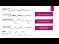 CTG INTERPRETATION