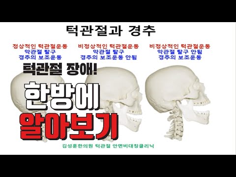 재발 없는 턱관절 관리법
