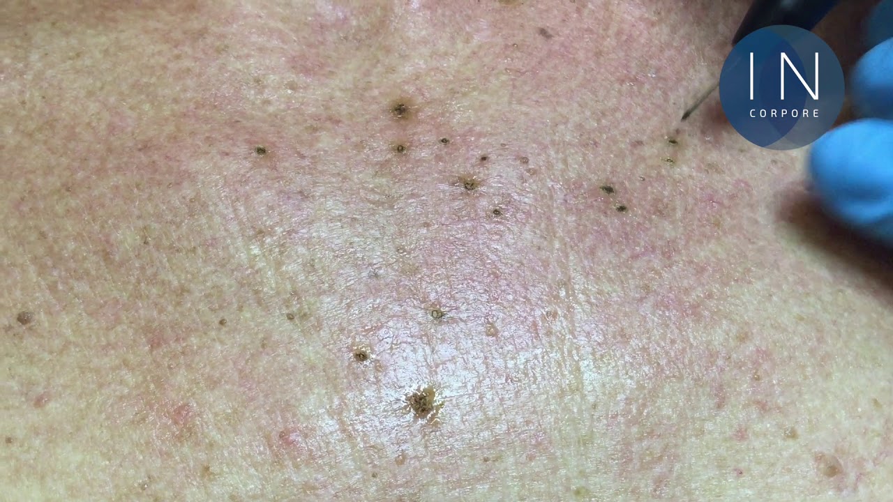 Juan Enrique Pérez Enríquez-182