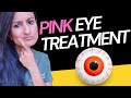 Doc Reveals Truth On How To Treat Pink Eye At Home | How to cure pink eye | What causes pink eye |