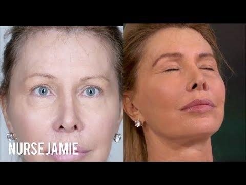 Before and After Eyebrow Threading | Nurse Jamie