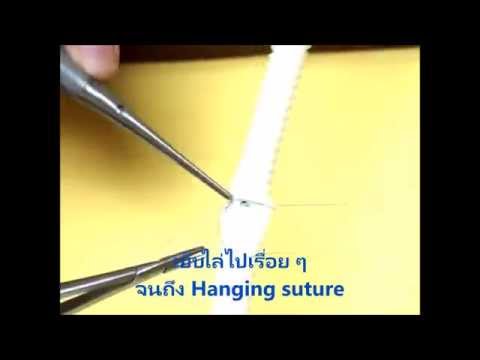 Parachute vascular anastomosis technique