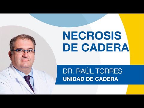 Necrosis de Cadera